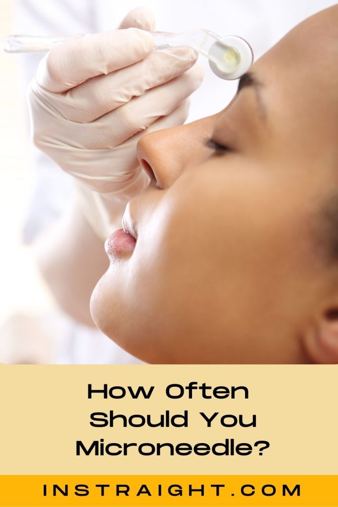 lady getting microneedling sessions